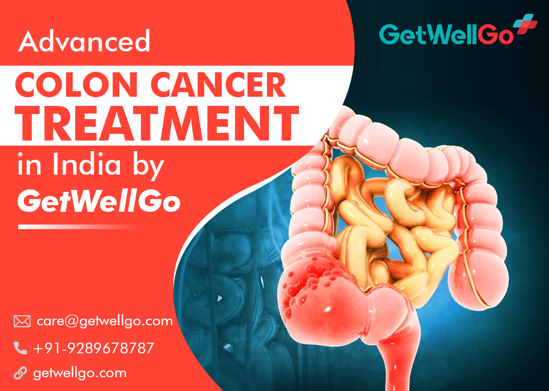 Advanced Colon Cancer treatment in India by GetWellGo