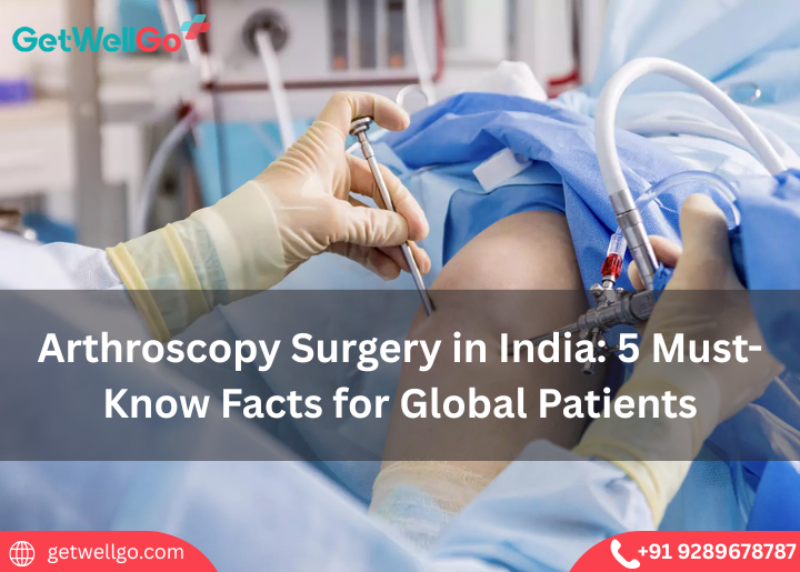 Arthroscopy Surgery in India: 5 Must-Known Facts for Global Patients