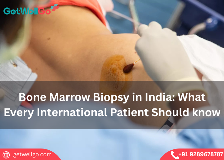 Bone Marrow Biopsy in India: What Every International Patient Should know