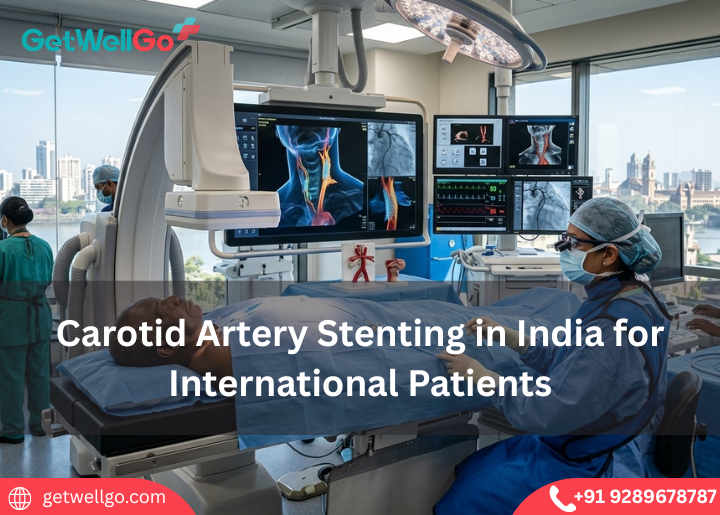 Carotid Artery Stenting in India for International Patients