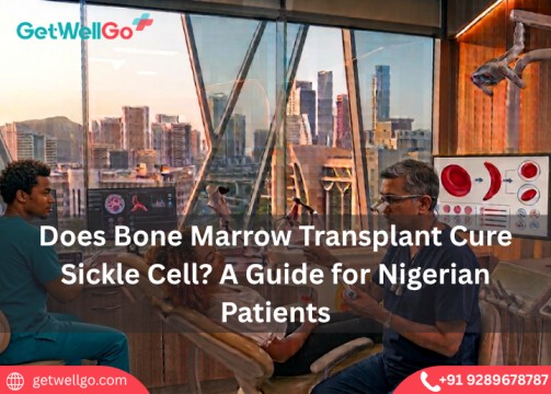 Does Bone Marrow Transplant Cure Sickle Cell? A Guide for Nigerian Patients