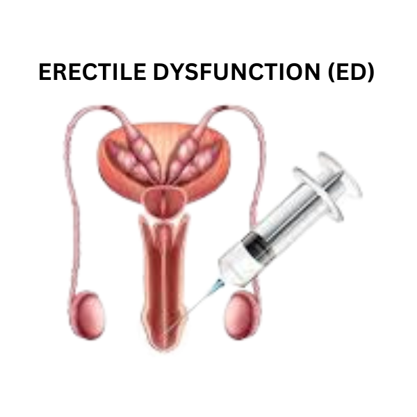 ERECTILE DYSFUNCTION TREATMENT