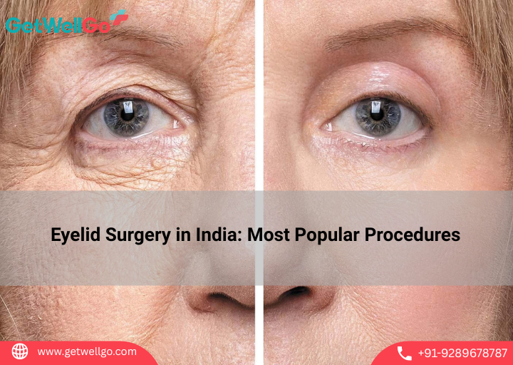Eyelid Surgery in India: Most Popular Procedures