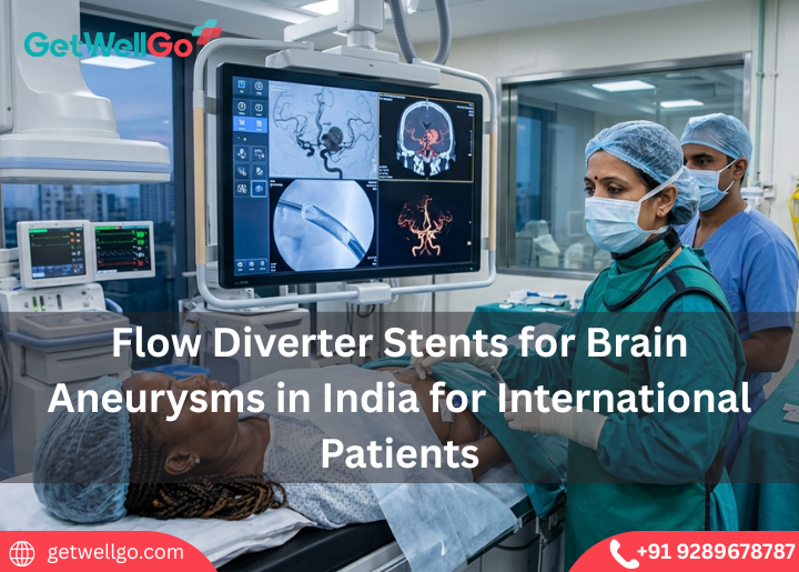 Flow Diverter Stents for Brain Aneurysms in India for International Patients
