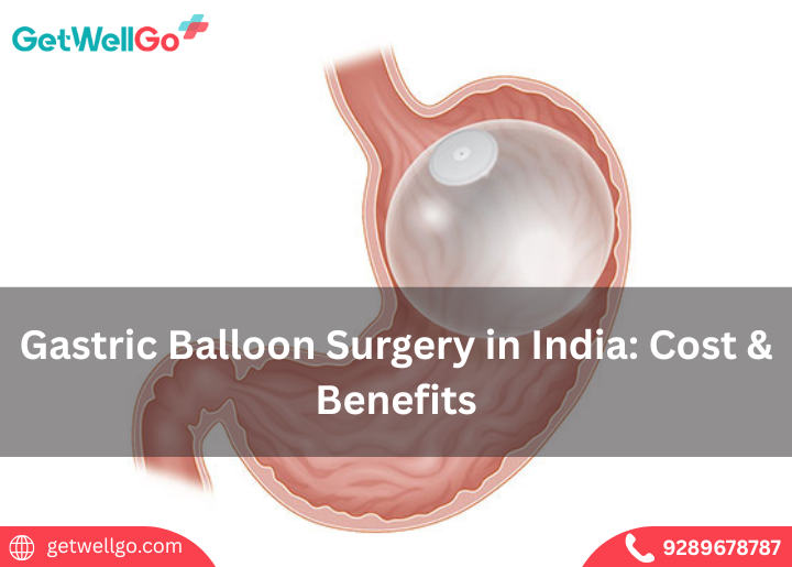 Gastric Balloon Surgery in India: Cost & Benefits