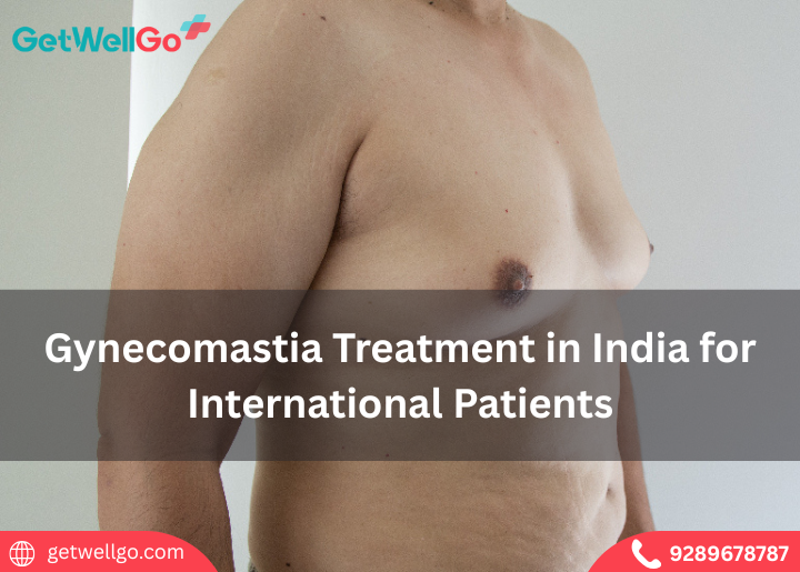 Gynecomastia Treatment in India for International Patients