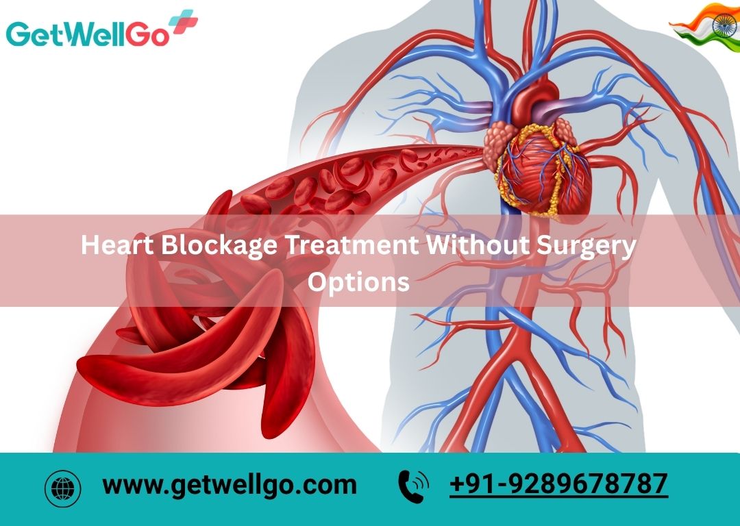 Heart Blockage Treatment Without Surgery Options