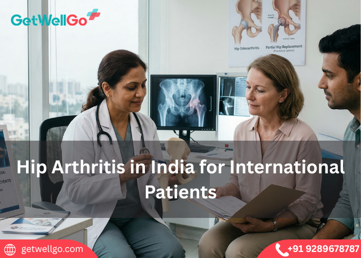 Hip Arthritis in India for International Patients