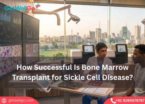 How Successful Is Bone Marrow Transplant for Sickle Cell Disease?