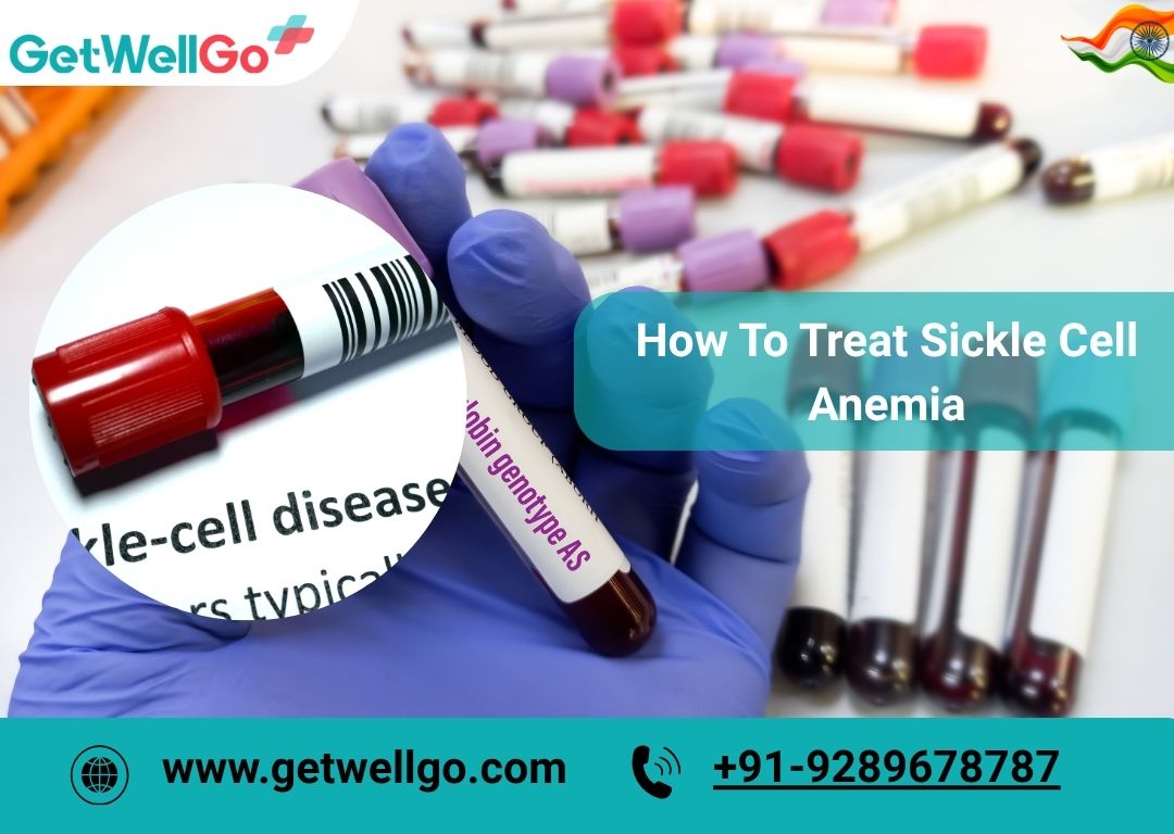 How To Treat Sickle Cell Anemia