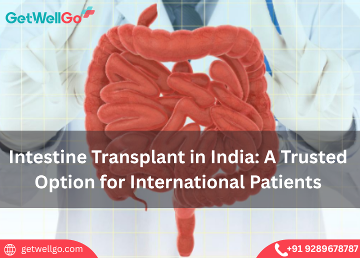 Intestine Transplant in India: A Trusted Option for International Patients