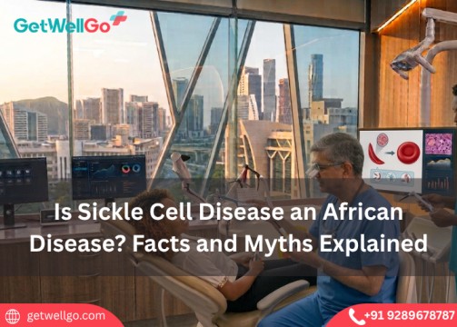 Is Sickle Cell Disease an African Disease? Facts and Myths Explained