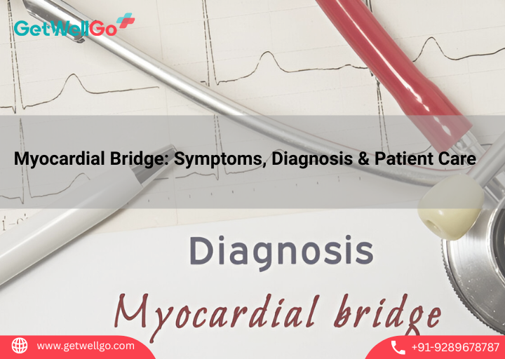 Myocardial Bridge: Symptoms, Diagnosis & Patient Care