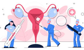 Ovarian Cancer Treatment