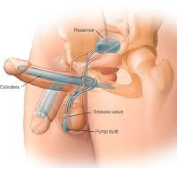 PENIS ENLARGEMENT SURGERY