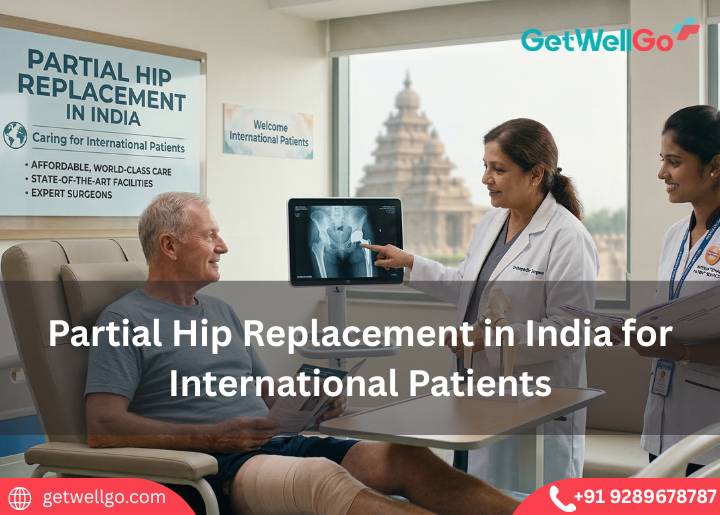 Partial Hip Replacement in India for International Patients
