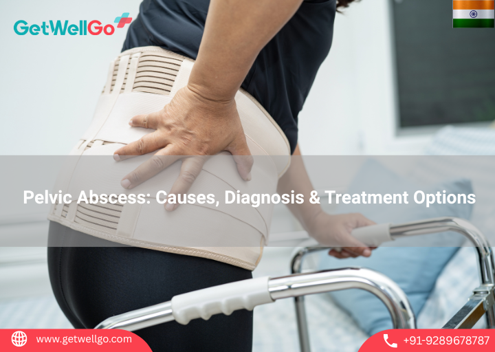 Pelvic Abscess: Causes, Diagnosis & Treatment Options