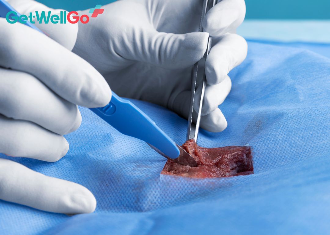 Penis Enlargement Surgery: How it Works and Risks