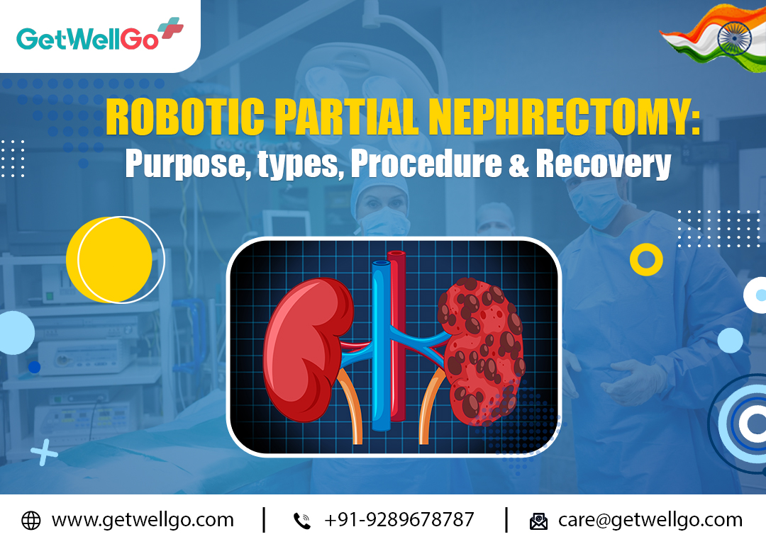 Robotic Partial Nephrectomy: Purpose, Types, Procedure & Recovery