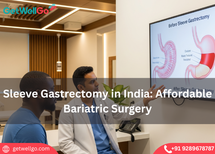 Sleeve Gastrectomy in India: Affordable Bariatric Surgery