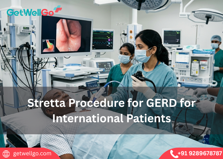 Stretta Procedure for GERD for International Patients