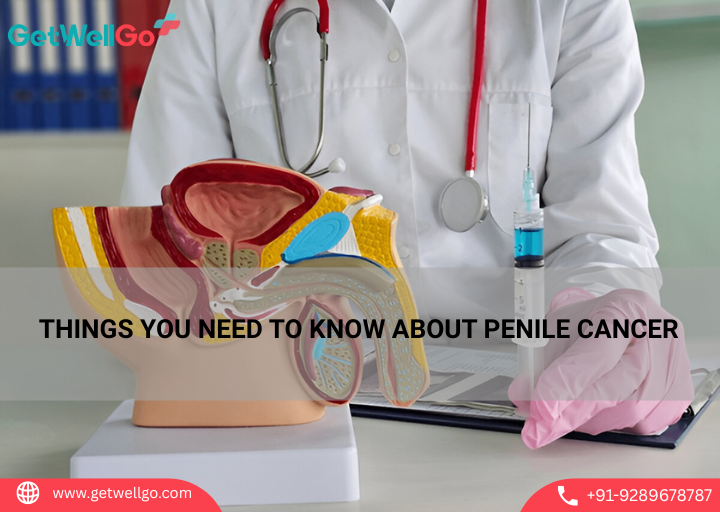 THINGS YOU NEED TO KNOW ABOUT PENILE CANCER