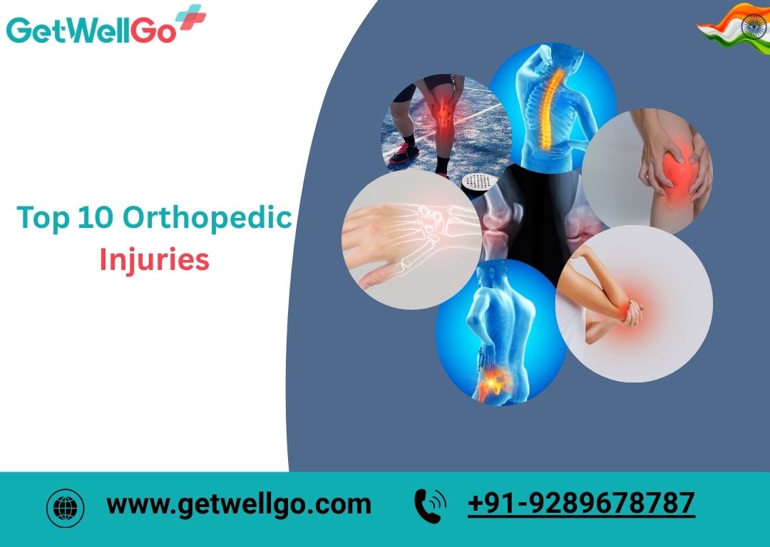 Top 10 Orthopedic Injuries: Causes, Symptoms, and Treatment Options