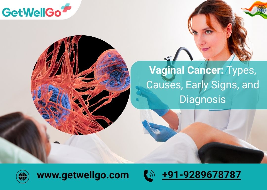 Vaginal Cancer: Types, Causes, Early Signs, and Diagnosis