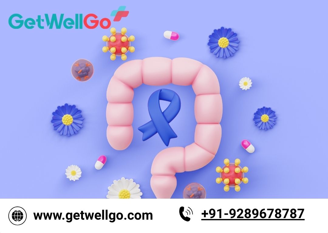 Bowel Cancer | Causes, Symptoms and Treatment